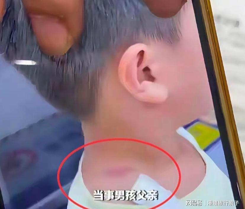 40岁硬汉孔帕尼晕倒!极致工作狂:长期熬夜睡眠少 拜仁强制他休息